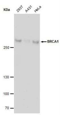 Western Blot: BRCA1 Antibody (17F8) [NBP1-41185]
