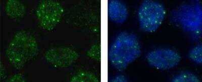 Immunocytochemistry/ Immunofluorescence: BRCA1 Antibody (6B4) [NB100-404]