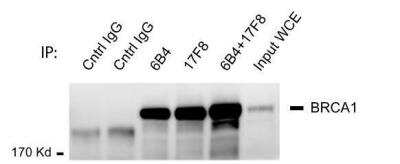 Immunoprecipitation: BRCA1 Antibody (6B4) [NB100-404]