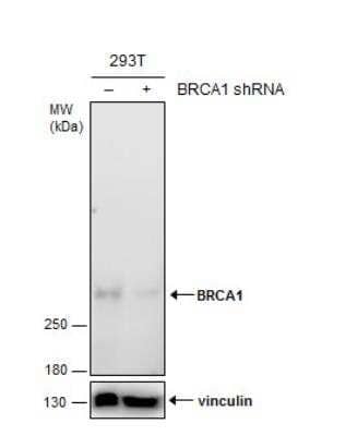 Knockdown Validated: BRCA1 Antibody (6B4) [NB100-404]