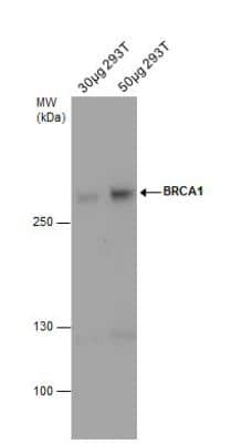 Western Blot: BRCA1 Antibody (6B4) [NB100-404]