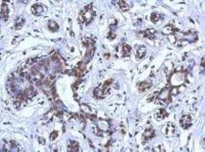 Immunohistochemistry: BRCA1 Antibody (8F7) [NBP1-41186]