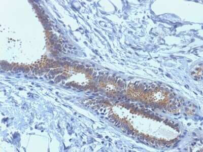 Immunohistochemistry-Paraffin: BRCA1 Antibody (BRCA1/1398) - Azide and BSA Free [NBP2-54305]