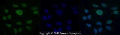 Immunocytochemistry/ Immunofluorescence: BRCA1 Antibody (KEN) - Azide and BSA Free [NBP2-80601]