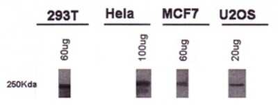 Western Blot: BRCA1 Antibody (KEN)BSA Free [NB100-599]