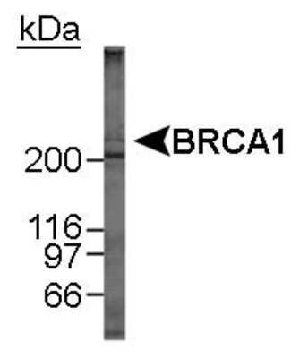Western Blot: BRCA1 Antibody (MU) [NB100-600]