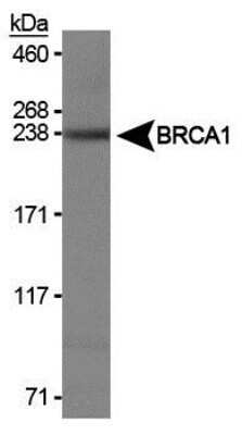 Western Blot: BRCA1 Antibody (RAY)Azide and BSA Free [NBP2-80600]