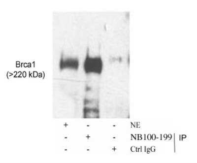 Western Blot: BRCA1 Antibody [NB100-199]