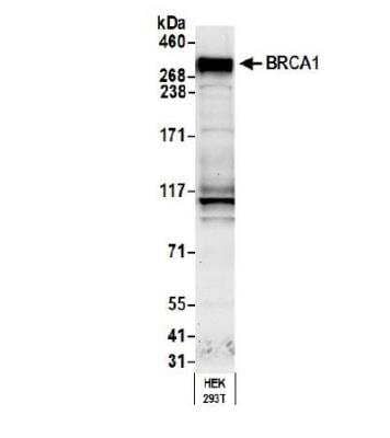 Western Blot: BRCA1 Antibody [NB100-199]