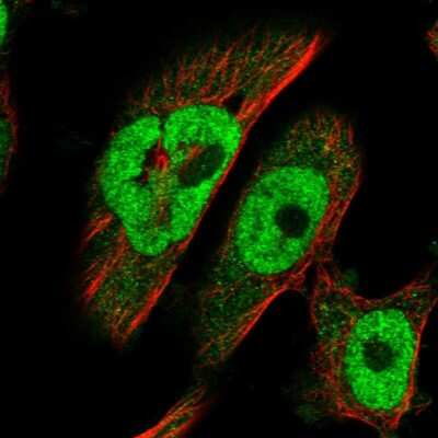 Immunocytochemistry/ Immunofluorescence: BRCA2 Antibody [NBP1-88361]