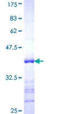 SDS-PAGE: Recombinant Human BRCA2 GST (N-Term) Protein [H00000675-Q01]