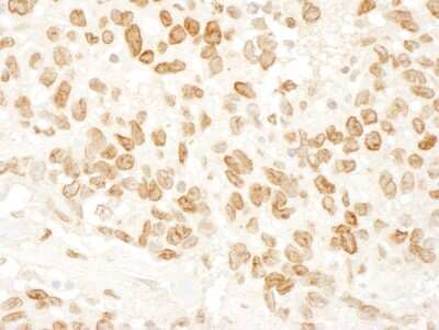 Immunohistochemistry: BRCAA1 Antibody [NBP1-26618]