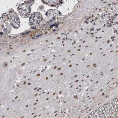 Immunohistochemistry: BRCAA1 Antibody [NBP1-90007]