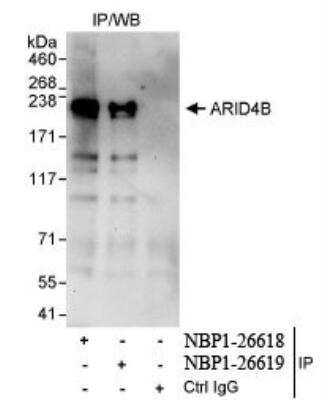 Immunoprecipitation: BRCAA1 Antibody [NBP1-26619]