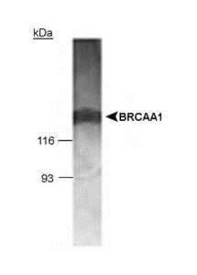 Western Blot: BRCAA1 AntibodyBSA Free [NB100-682]