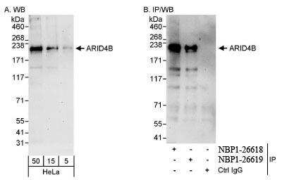 Western Blot: BRCAA1 Antibody [NBP1-26618]