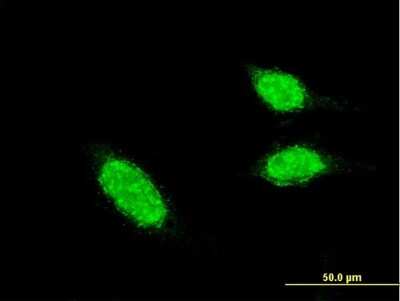 Immunocytochemistry/ Immunofluorescence: BRCC2 Antibody (3F4) [H00414899-M05]