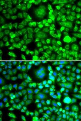 Immunocytochemistry/ Immunofluorescence: BRCC2 Antibody - BSA Free [NBP2-92672]