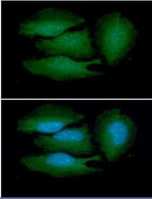 Immunocytochemistry/ Immunofluorescence: BRCC3 Antibody (3B1) - BSA Free [NBP1-30429]