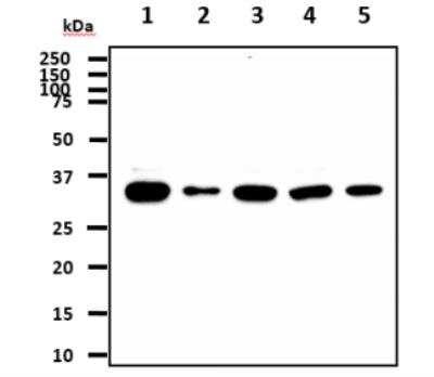 Western Blot: BRCC3 Antibody (3B1)BSA Free [NBP1-30429]