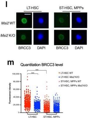 Immunocytochemistry/ Immunofluorescence: BRCC3 Antibody - BSA Free [NBP1-76831]