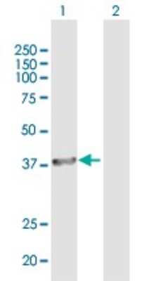 Western Blot: BRCC3 Antibody [H00079184-B01P]