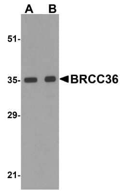 Western Blot: BRCC3 AntibodyBSA Free [NBP1-76831]