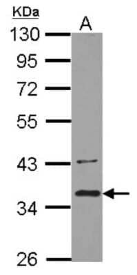 Western Blot: BRCC3 Antibody [NBP2-15609]