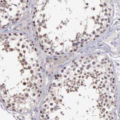 Immunohistochemistry: BRD1 Antibody [NBP1-88352]