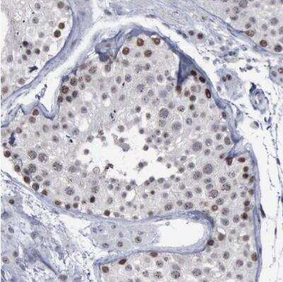 Immunohistochemistry-Paraffin: BRD1 Antibody [NBP1-88351]