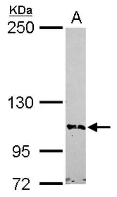 Western Blot: BRD1 Antibody [NBP2-15611]