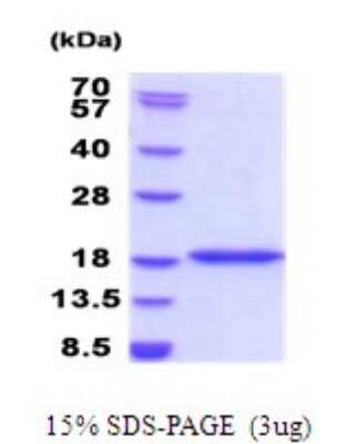 SDS-PAGE: Recombinant Human BRD1 His Protein [NBP2-51877]