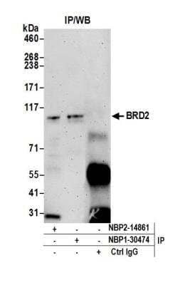 Immunoprecipitation: BRD2 Antibody (12C2E4) [NBP2-14861]