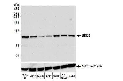 Western Blot: BRD2 Antibody (BL-167-2A2) [NBP2-76410]