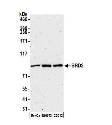 Western Blot: BRD2 Antibody (BL-167-2A2) [NBP2-76410]