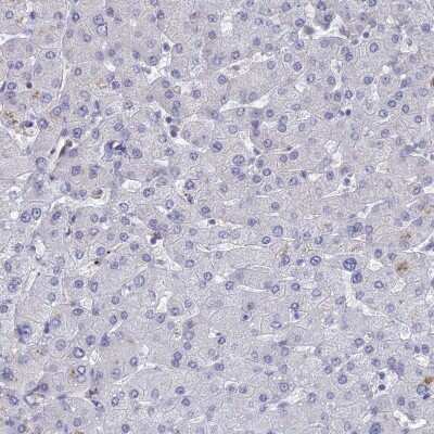 Immunohistochemistry-Paraffin: BRD2 Antibody [NBP1-84310]