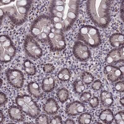 Immunohistochemistry-Paraffin: BRD2 Antibody [NBP1-84310]