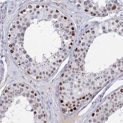Immunohistochemistry-Paraffin: BRD2 Antibody [NBP1-84310]