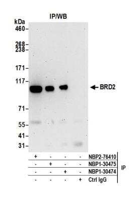 Immunoprecipitation: BRD2 Antibody [NBP1-30474]