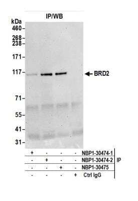 Immunoprecipitation: BRD2 Antibody [NBP1-30474]