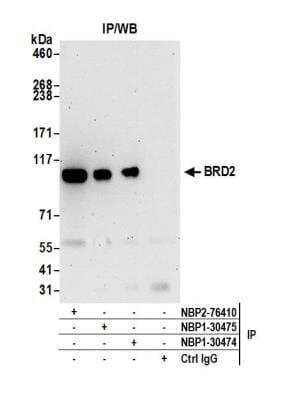 Immunoprecipitation: BRD2 Antibody [NBP1-30475]