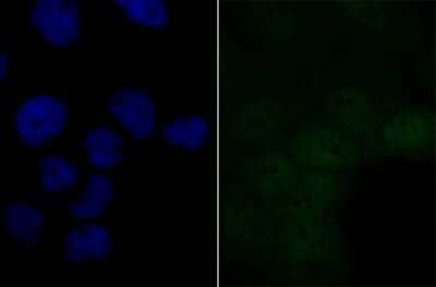 Immunocytochemistry/ Immunofluorescence: BRD2 Antibody (JG40-42) [NBP2-75422]