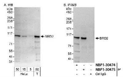 Western Blot: BRD2 Antibody [NBP1-30474]