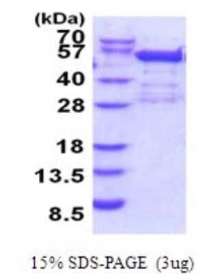 SDS-PAGE: Recombinant Human BRD2 His Protein [NBP2-51885]