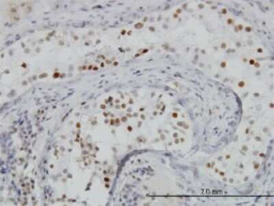 Immunohistochemistry-Paraffin: BRD3 Antibody (6E7) [H00008019-M01]
