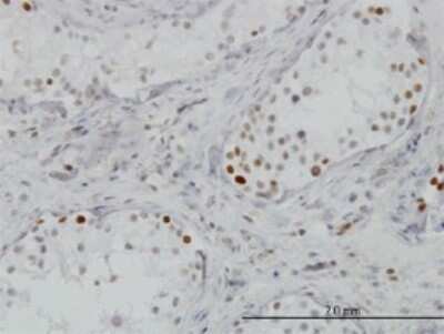 Immunohistochemistry-Paraffin: BRD3 Antibody (7G6) [H00008019-M02]