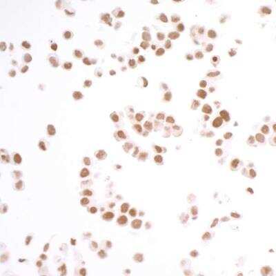 Immunocytochemistry: BRD3 Antibody (BLR069G) [NBP2-77359]