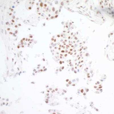 Immunohistochemistry: BRD3 Antibody (BLR069G) [NBP2-77359]
