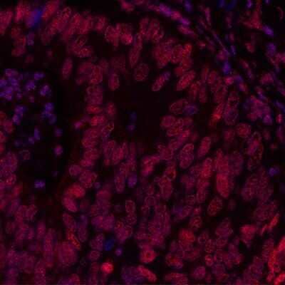 Immunohistochemistry: BRD3 Antibody (BLR069G) [NBP2-77359]