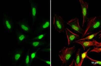 Immunocytochemistry/ Immunofluorescence: BRD3 Antibody [NBP2-15612]